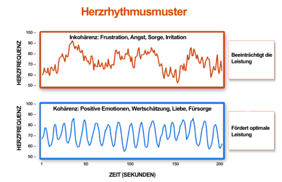 Übersicht über die Herzfrequenzvariabilität - Abbildung 10