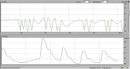 emWave Pro Plus Software Tour - Abbildung 38
