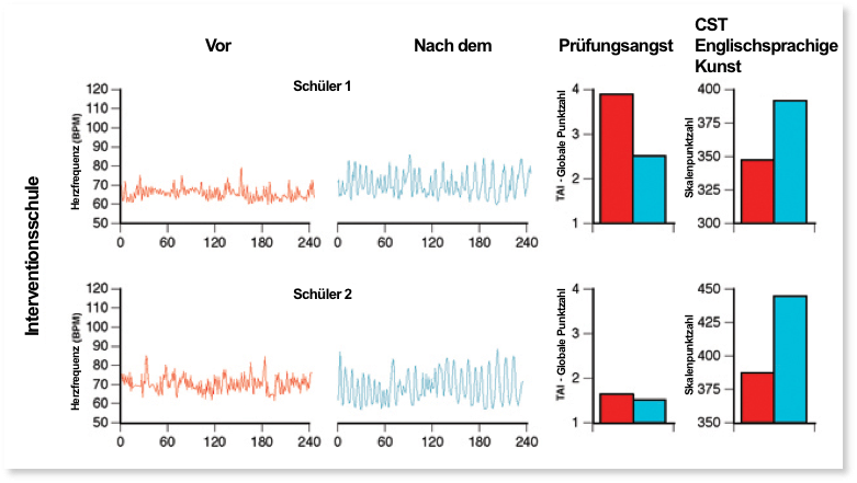 Übersicht über die Herzfrequenzvariabilität - Abbildung 11